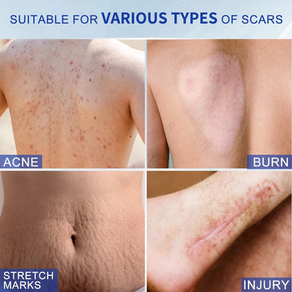 Silicone Scar Removal Gel